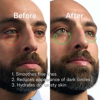 Rapid Restore Eye Patches - 6 pack